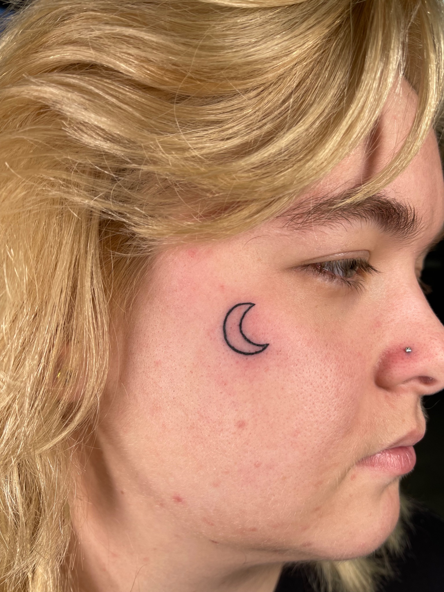 Recovered tattoo still