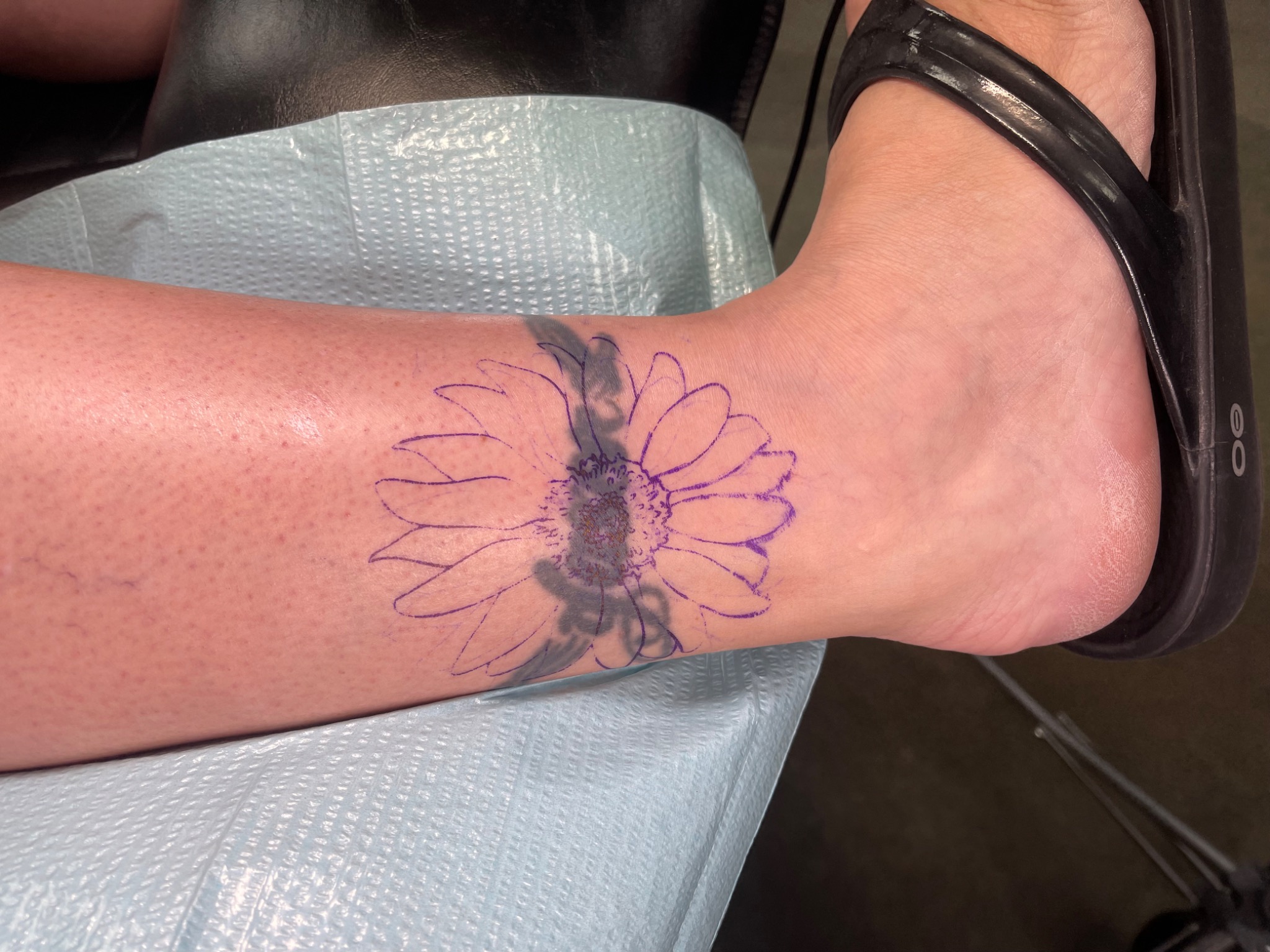 Recovered tattoo view