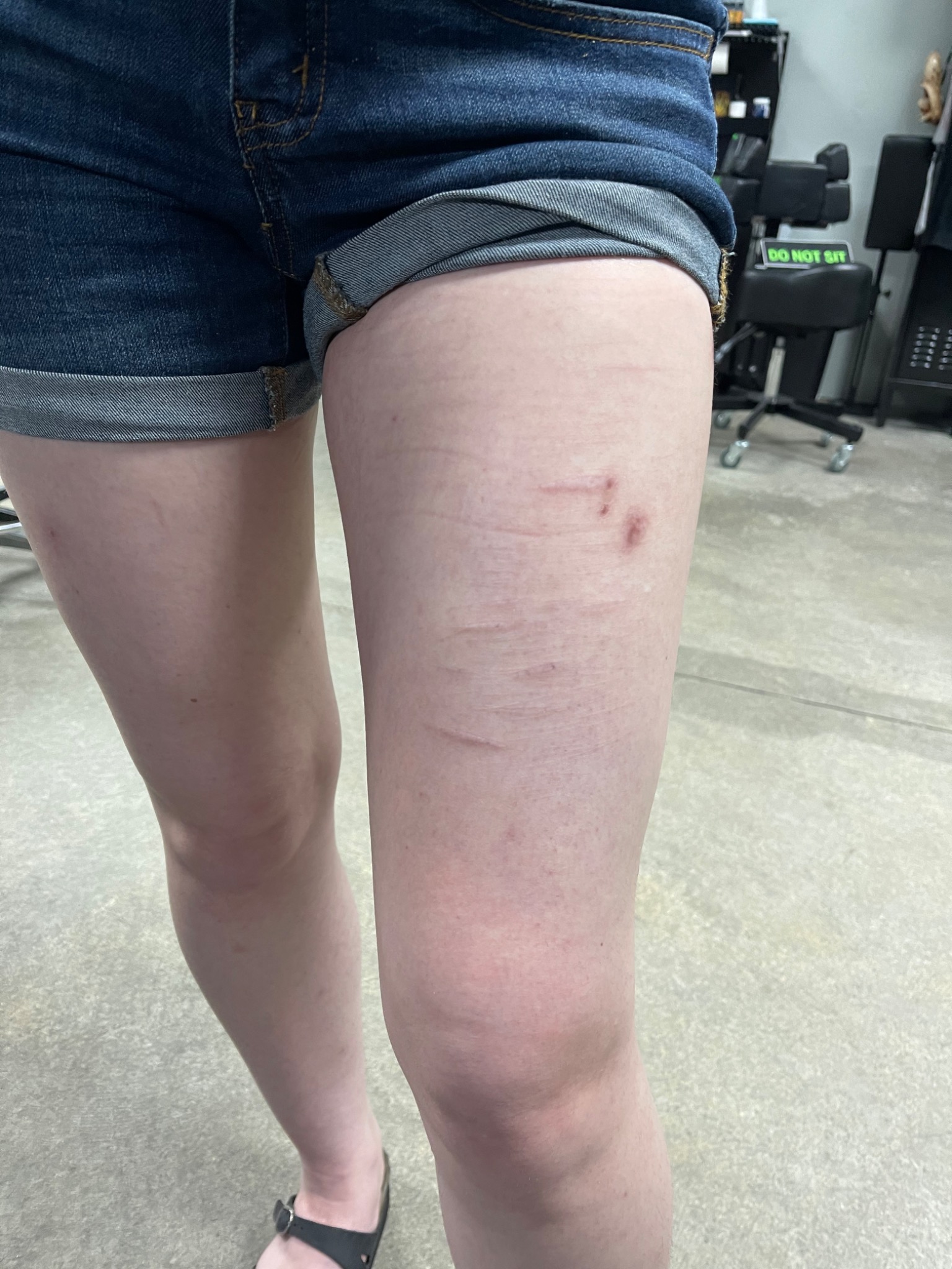 Recovered tattoo still