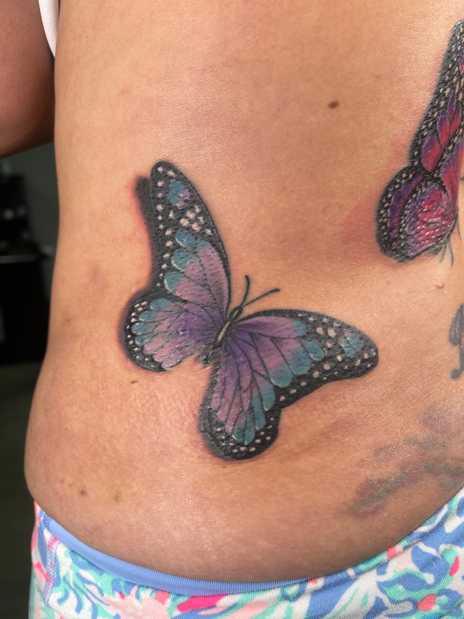 Recovered tattoo view