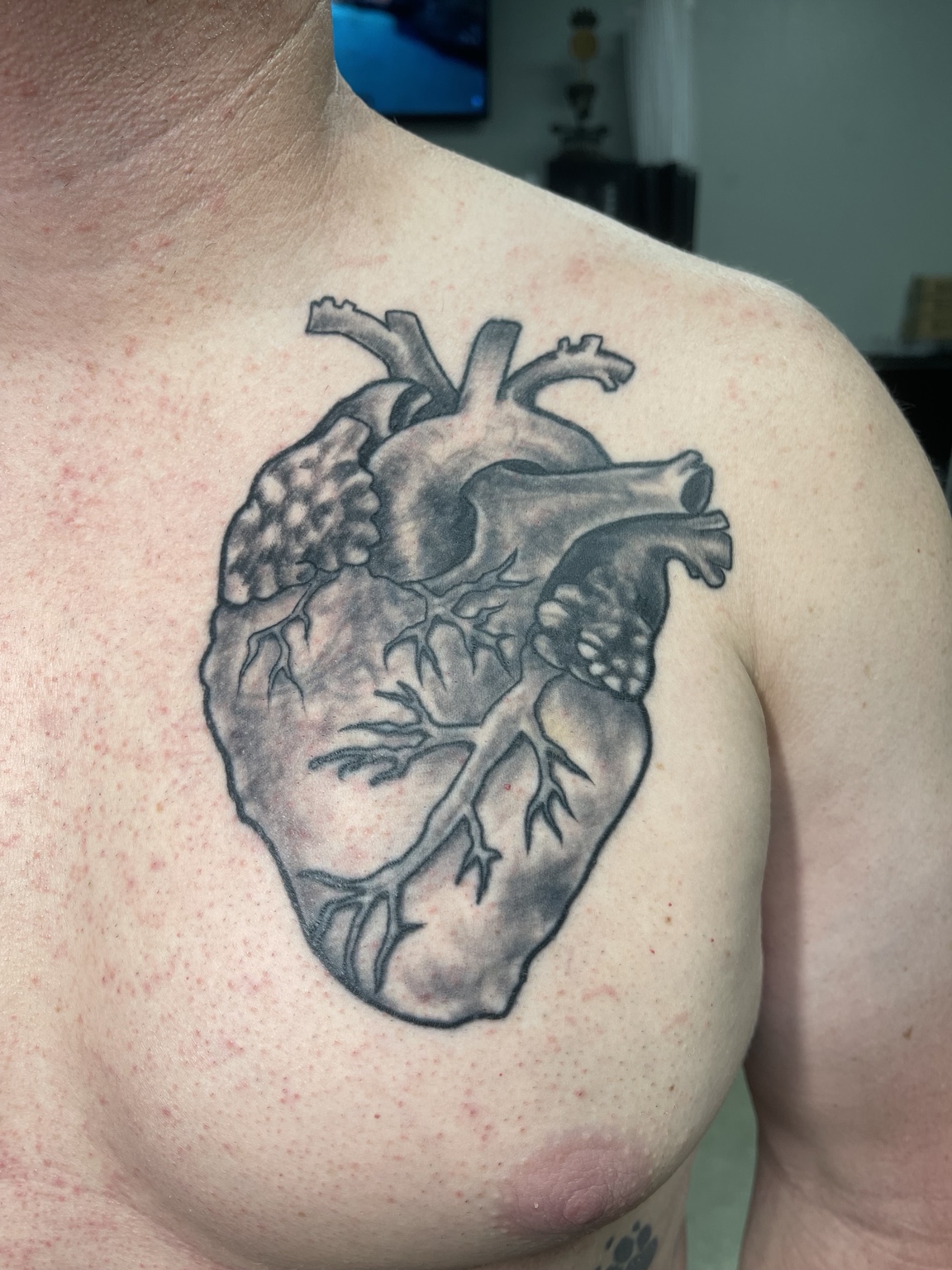 Recovered tattoo view